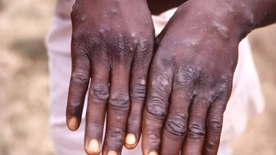 mpox